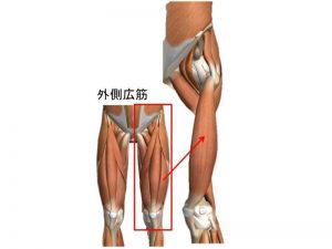 歩くと太ももの外側が張ってしまう方の対策方法 滋賀県守山市 大阪本町の姿勢改善専門スタジオ Be Style ビースタイル マンツーマン パーソナル指導